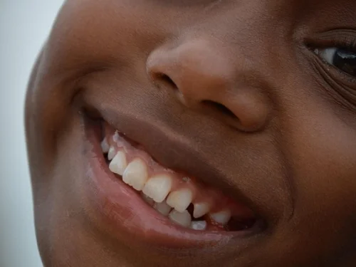 Hastanede Hasta Başında Beklemek: Rüya Sırları